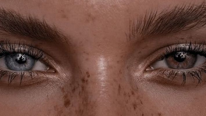 Можно ли покупать глазные капли без рецепта?