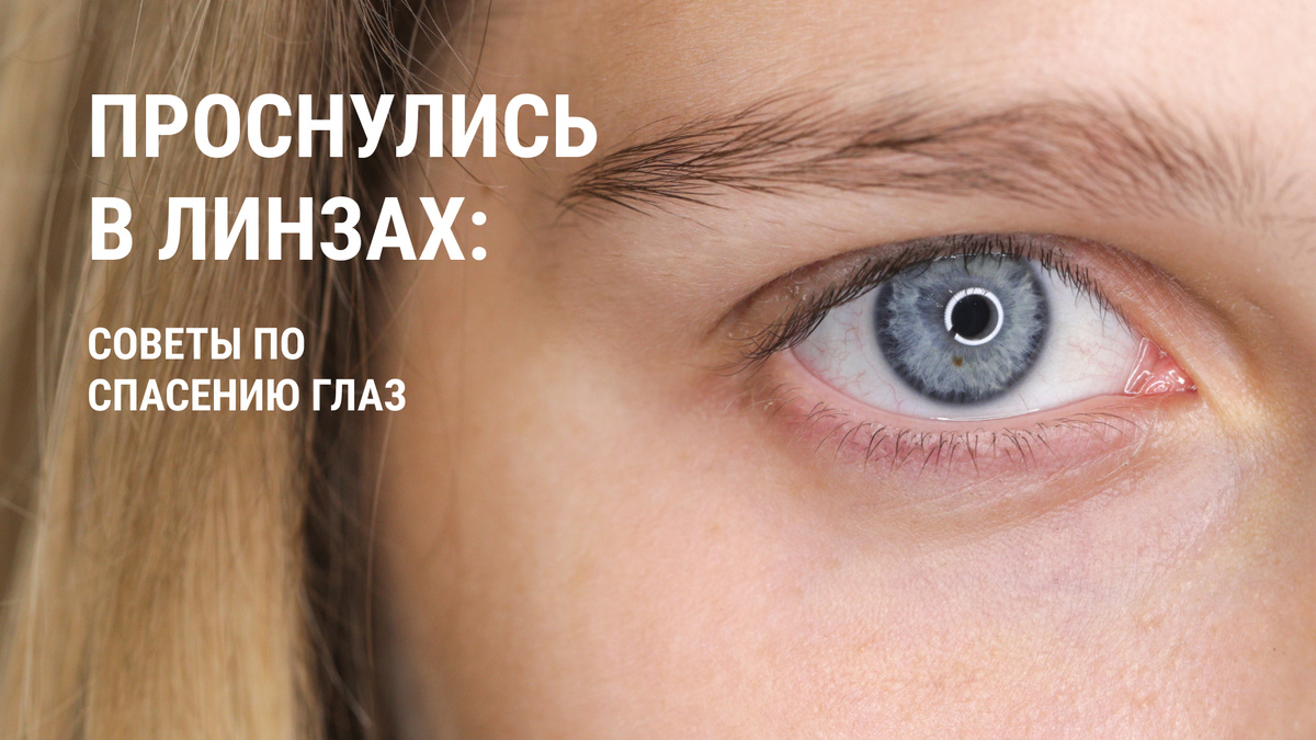 Что делать, если вы уснули в линзах?